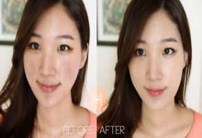 Quy tr&igrave;nh mở cửa l&agrave;n da hiện đang được ph&aacute;i đẹp m&ecirc; mệt